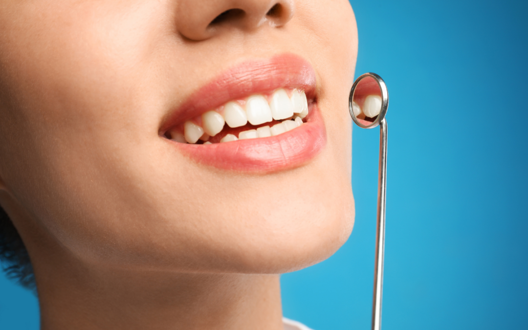 Cosmetic Dentist in Webster