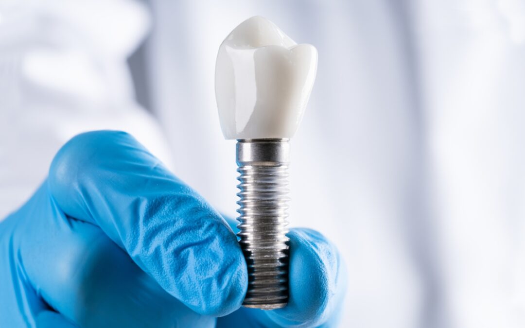 Good Candidate for Dental Implants