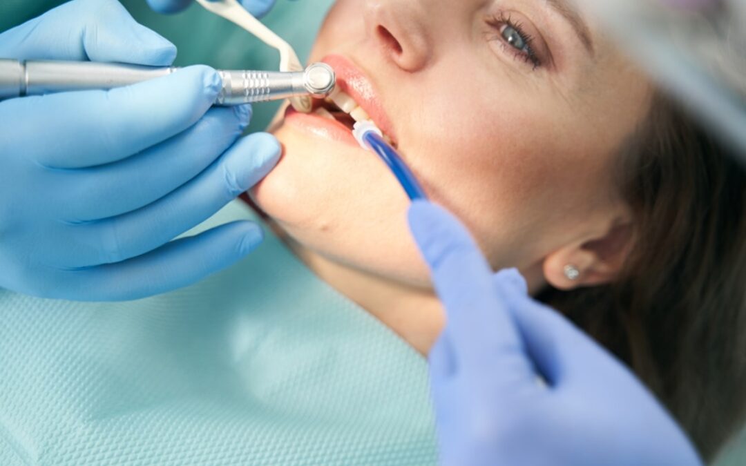 Effective Treatments For Managing Fluorosis
