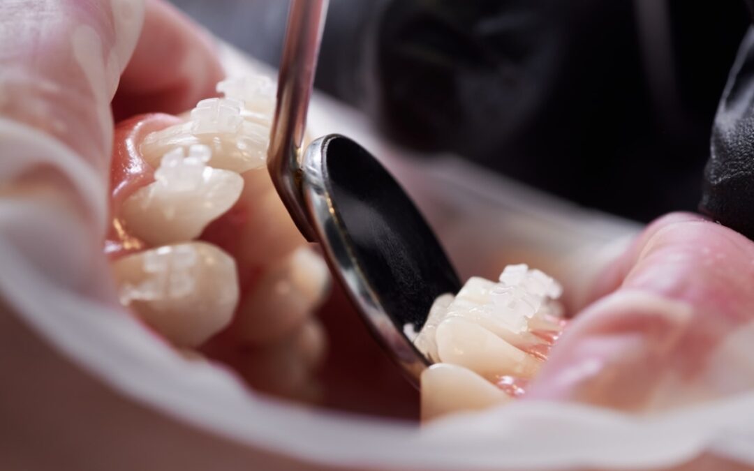 Cosmetic Dentist Webster