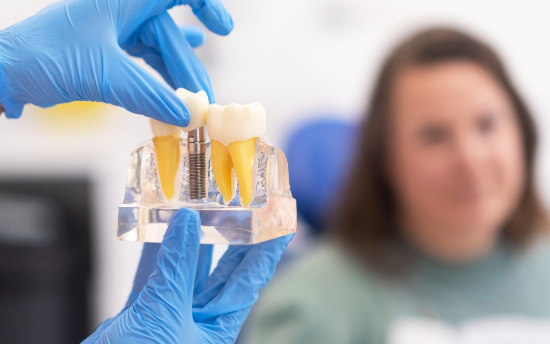 Are Dental Implants Painful