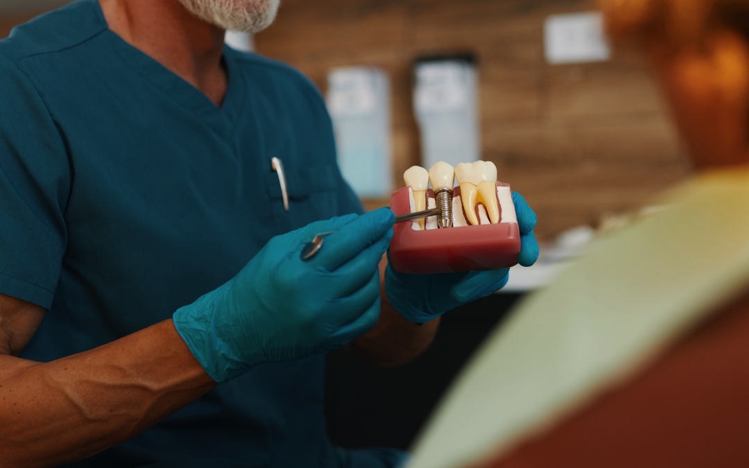 Can You Get an Implant if You Grind Your Teeth