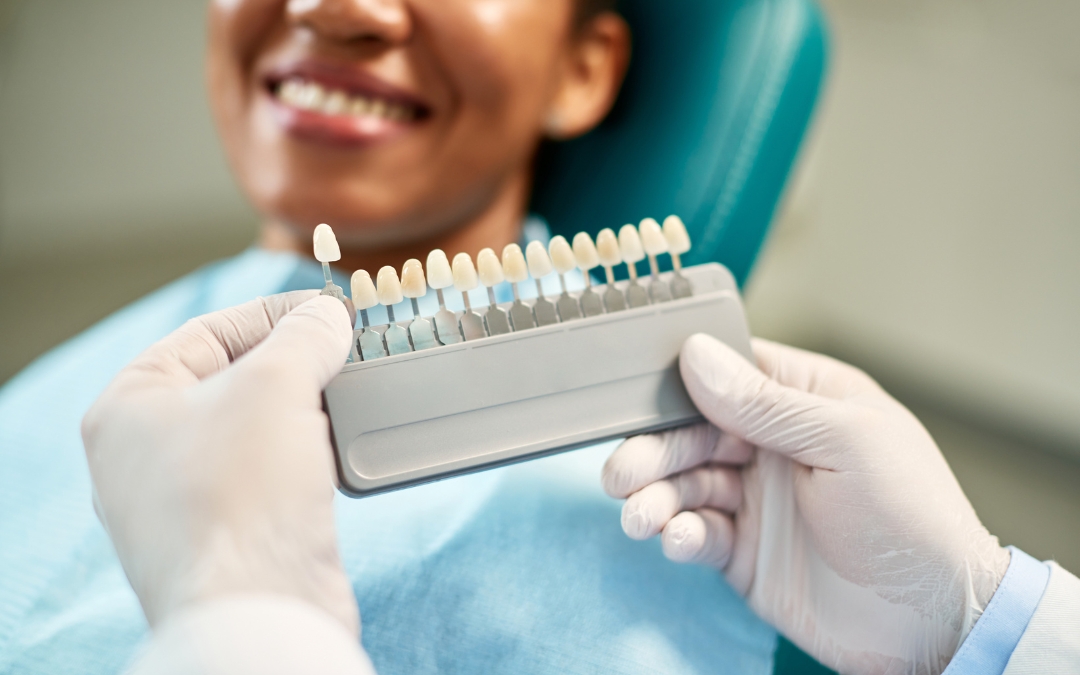 Why Are Minimal-Prep Veneers Becoming So Popular