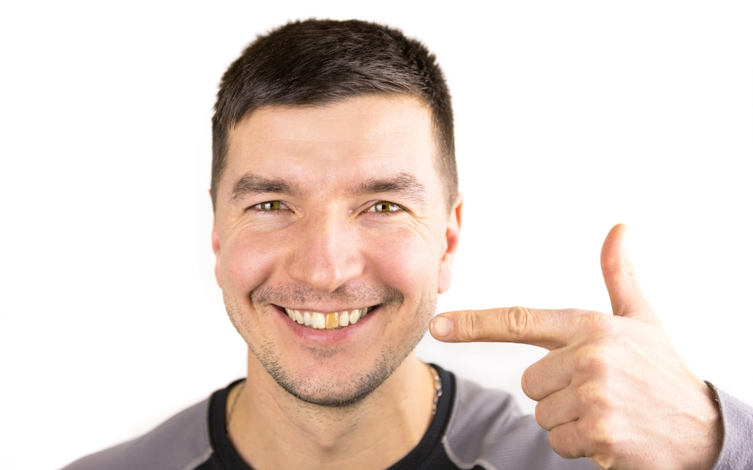 Tooth Turning Black But No Pain Discover the Reasons