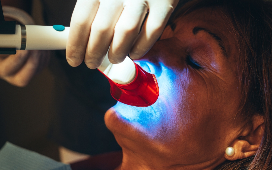 How Do You Treat Burning Gums from Teeth Whitening?